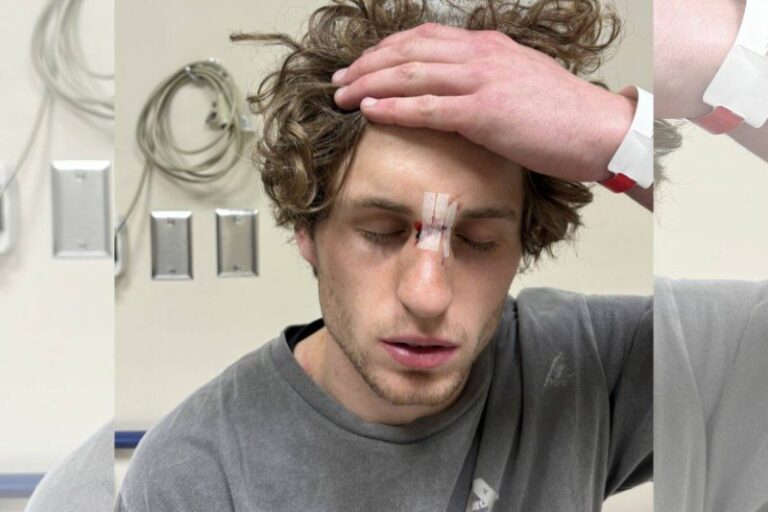 U21 Hockey Assault in Comox Valley: Player Speaks Out – B.C. Hockey Player Speaks Out After On-ice Assault During 2024 Game